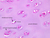 a72 hyaline cartilage trachea 40x pas labeled.jpg