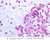 a9 secondary ossification 40x labeled.jpg