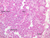 b43 submandibular gland mix 10x he labeled.jpg
