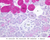 b43 submandibular gland mix 40x pas labeled.jpg