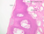 a55 lip transition 10x labeled.jpg
