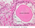 b90 prostate adult 40x he labeled.jpg
