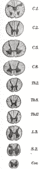 SpinalCord.gif