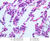 a74 lung 40x labeled.jpg