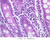 b12 lacteal jejunum 40x labeled.jpg