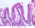 b12b lacteal jejunum 20x labeled.jpg
