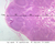 a32 lymph node 2x labeled.jpg