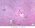b67 arcuate artery kidney 2x labeled.jpg