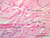 a48 reticular layer 10x labeled.jpg