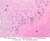 a50a thick skin 40x labeled.jpg