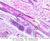 a49b hair scalp 20x labeled.jpg