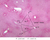 b31 liver 2x pas labeled.jpg