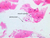 a91 muscle spindle lumbrical 40x labeled.jpg