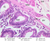 b12 plasma cell jejunum 40x labeled.jpg