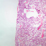 A4, Bone Marrow, 2.5x (H&E)