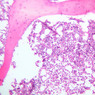 A4, Bone Marrow, 10x (H&E)