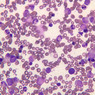A5, Bone Marrow, 40x (Wright)