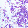 A5, Bone Marrow, 20x (Wright)