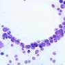 A5, Bone Marrow, 40x (Wright)
