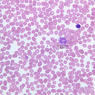 blood