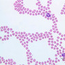 blood