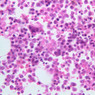 blood