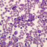 blood