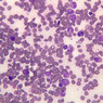 blood
