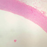 A26, Aorta, 2.5x (H&E)