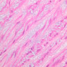 A26, Aorta, 40x (H&E)