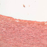 A27, Aorta, 10x (Verhoeff)