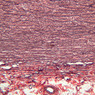 A27, Aorta, 10x (Verhoeff)