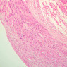 A28, Renal Artery (Kidney), 10x (H&E)