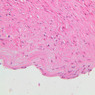 A28, (Kidney) Renal Artery, 20x (H&E)