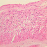 A28, Renal Artery (Kidney), 20x (H&E)