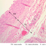 A28, Renal Artery (Kidney), 10x Labeled (H&E)