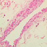 A48, Abdominal Skin, 20x (H&E)