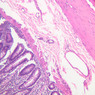 B12, Jejunum, 10x (H&E)