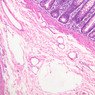 B12, Jejunum, 10x (H&E)