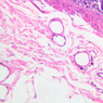 B12, Jejunum, 20x (H&E)