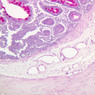 B13, Jejunum, 10x (PAS)
