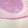 B13, Jejunum, 2.5x (PAS)