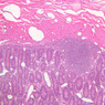 B15, Jejunum, 10x (H&E)