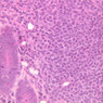 B15, Jejunum, 40x (H&E)