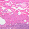 B15, Jejunum, 20x (H&E)