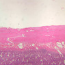 B15, Jejunum, 2.5x (H&E)