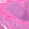 B16, Ileum, 10x (H&E)