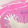 B16, Ileum, 2.5x (H&E)