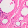 B23, Colon, 40x (H&E)