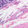 B24, Colon, 20x (H&E)